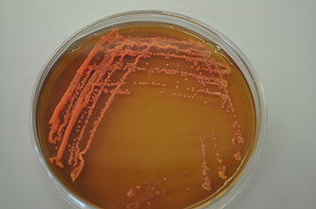 yeast plate, photo by Mari Piirainen