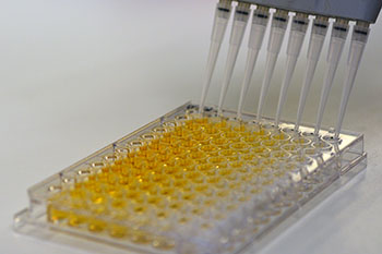 ELISA screening, photo by Mari Piirainen